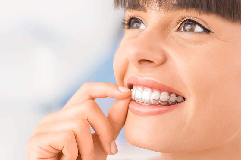 Invisalign for Teens & Adults in Miami